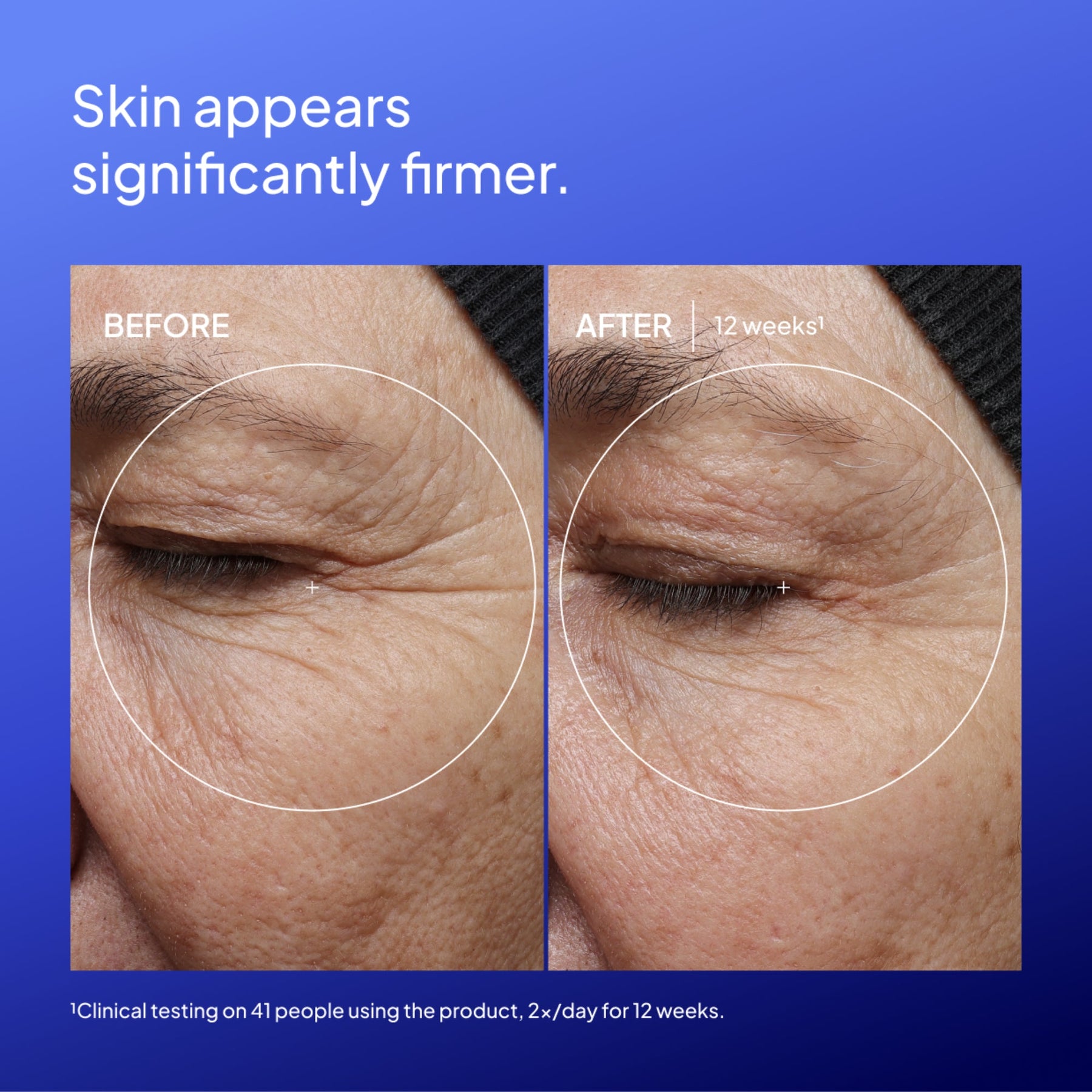 NIOD Copper Amino Isolate Lipid 1% - before and after results