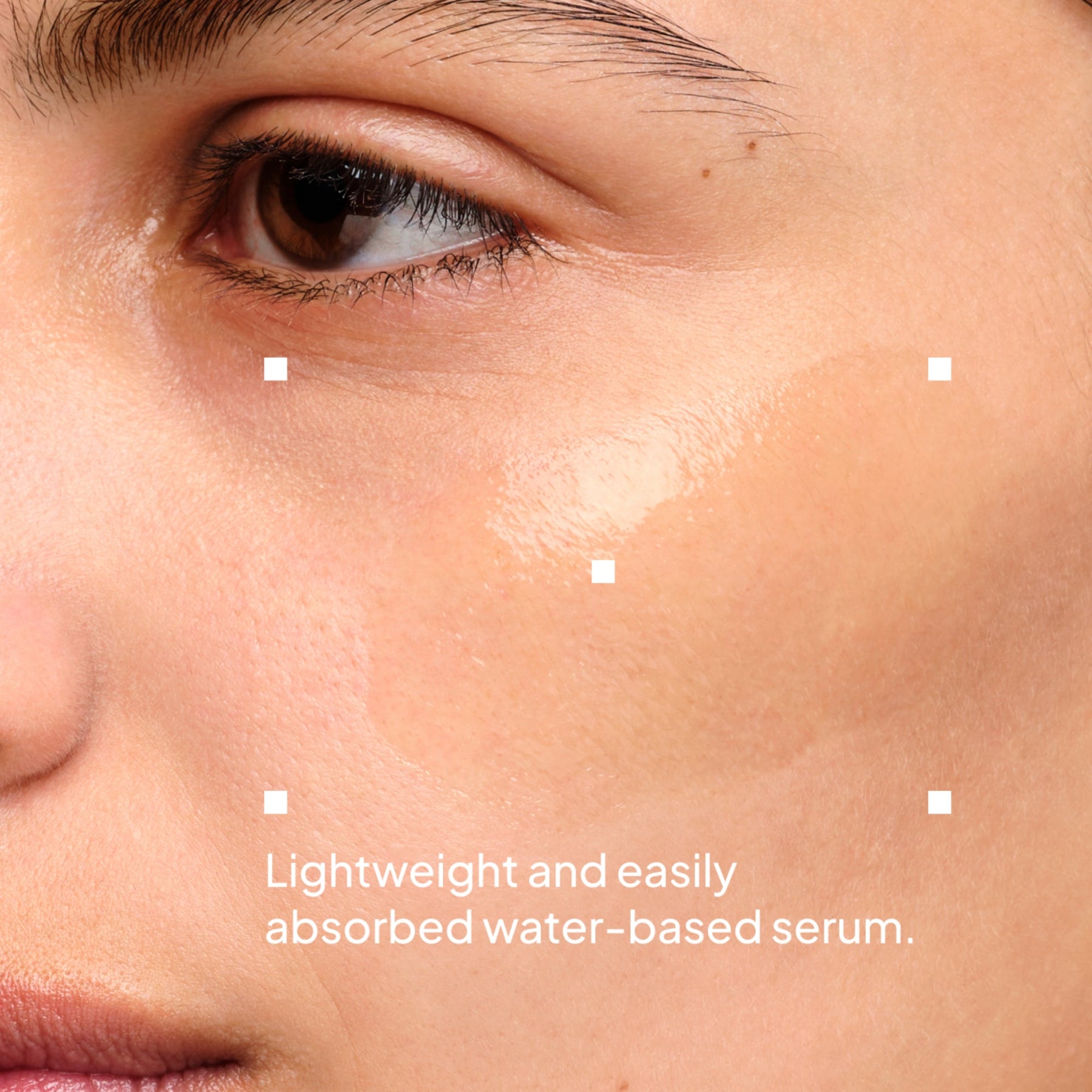NIOD Multi Molecular Hyaluronic Complex MMHC2 - what it is