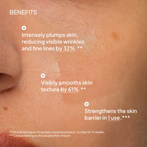 NIOD Multi Molecular Hyaluronic Complex MMHC2 - benefits